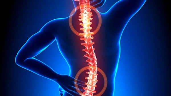 5 причин плохой осанки