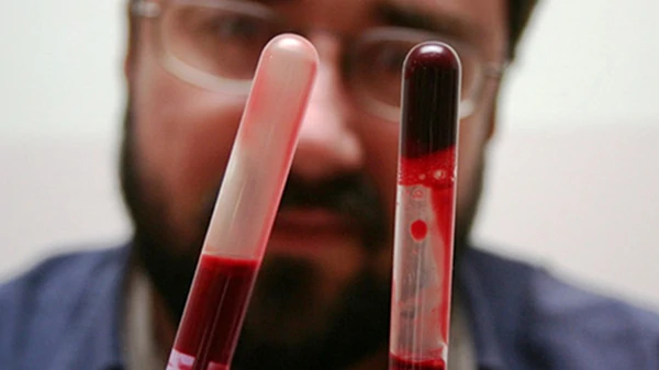 Чем опасна густая кровь и что надо делать