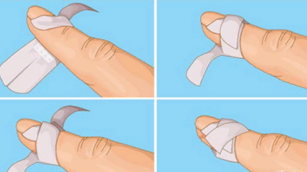 Как наклеить лейкопластырь на палец