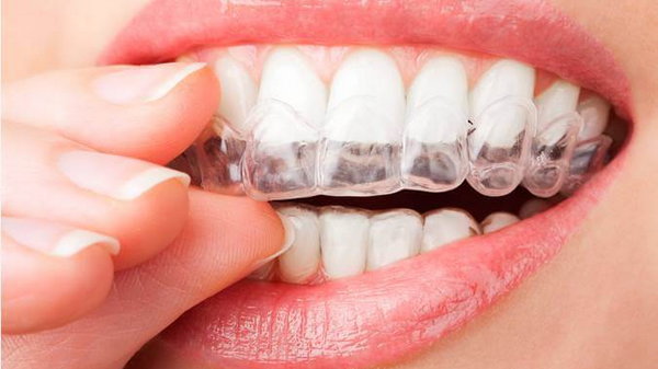 Насколько эффективна процедура отбеливания зубов
