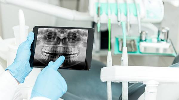 Диагностика зубов: назначение и показания