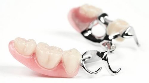 Что такое бюгельное протезирование зубов