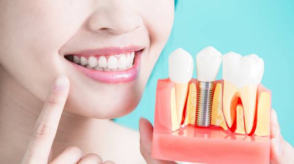 Установка зубных имплантатов: возрастные ограничения